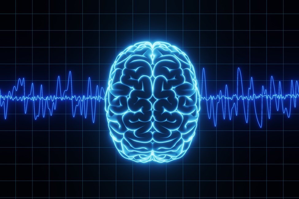 EEG sensors record brain activity (left), generating brainwave signals (middle) that are analyzed by explainable AI (top right) and mapped onto brain regions (bottom right) to detect and interpret dementia type and severity noninvasively.